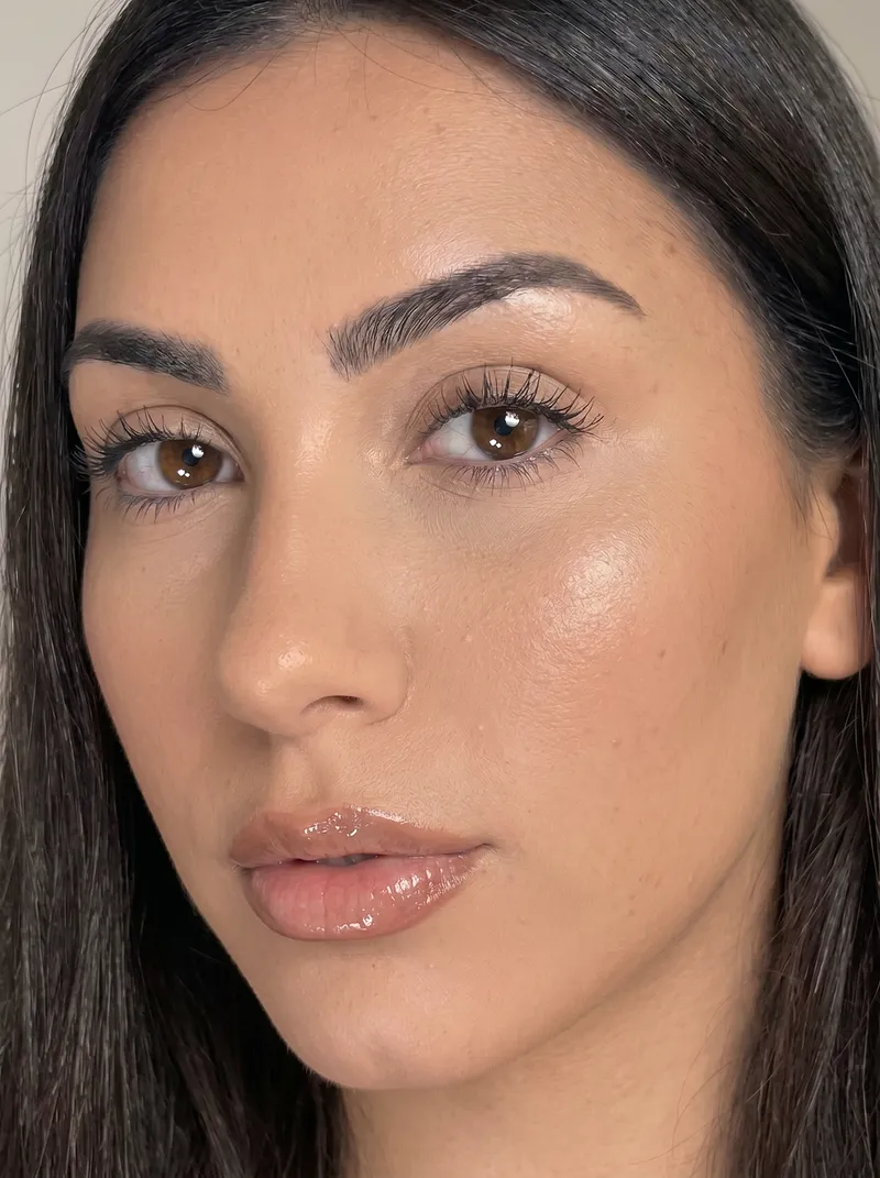 After Laser Resurfacing