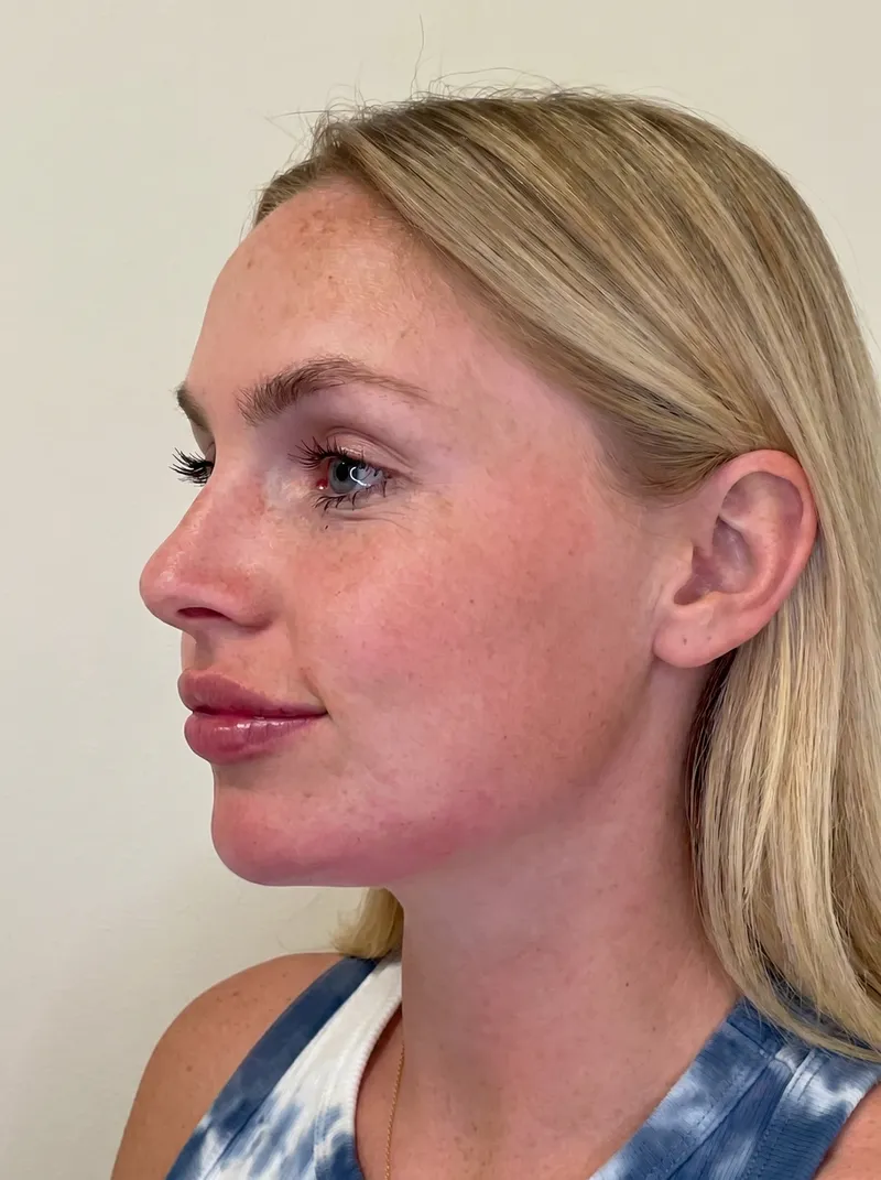 After IV Therapy Glow