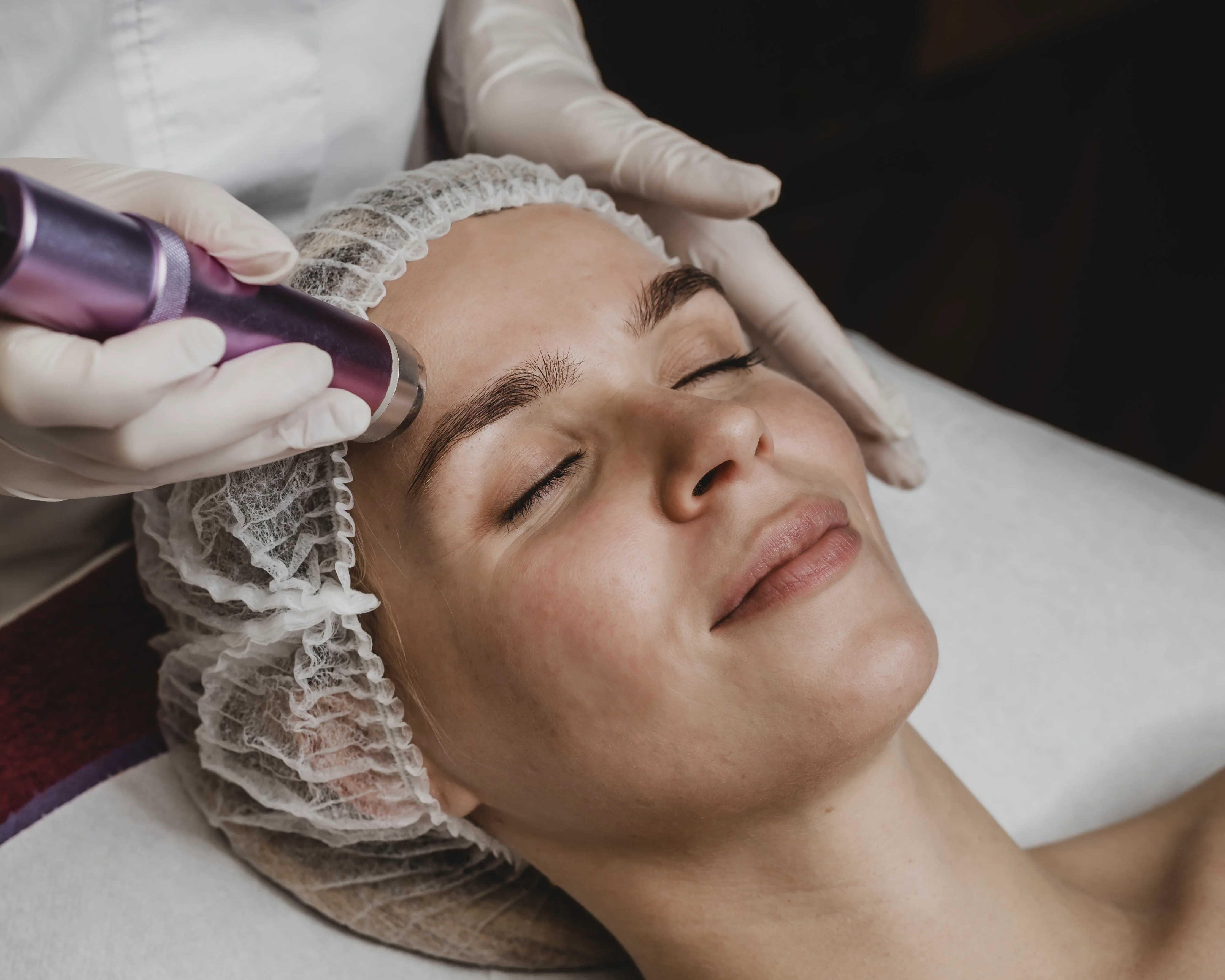 Microneedling pen used on a client